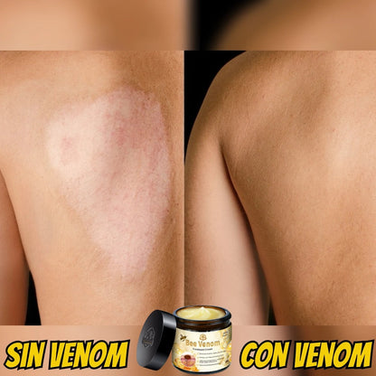 BEE VENOM: ¡El secreto milenario que desafía el tiempo en tu piel!